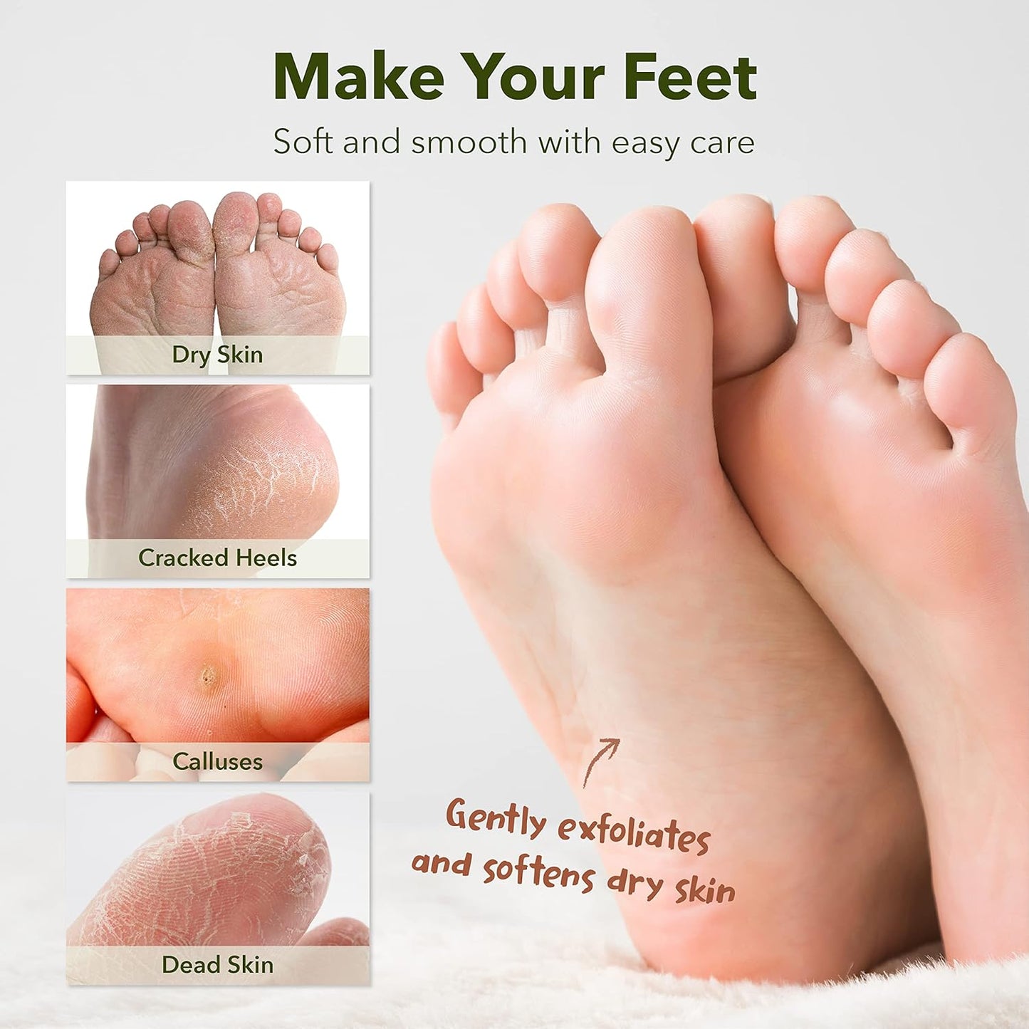 Claréa Foot Peel Mask 6 Pack – Exfoliating Mask for Calluses, Cracked Heels & Dry Skin